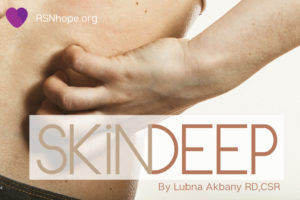 download skin deep skin